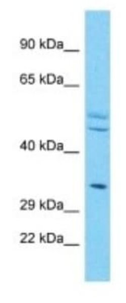 OR4X2 Rabbit anti-Human, Polyclonal, Novus Biologicals:Antibodies:Primary